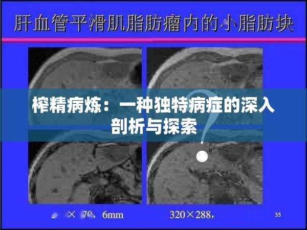 榨精病炼：一种独特病症的深入剖析与探索